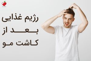 رژیم غذایی بعد از کاشت مو