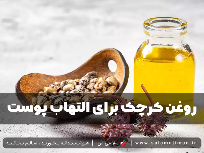 روغن کرچک برای التهاب پوست