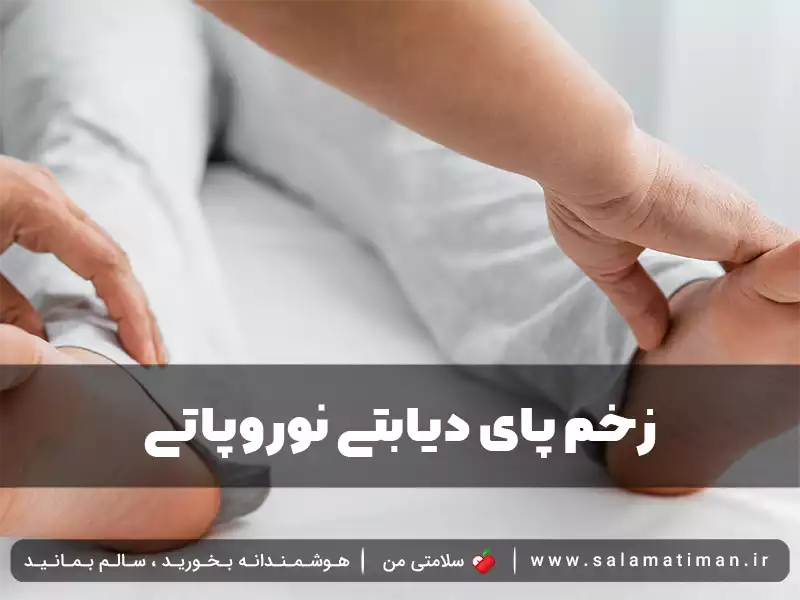 زخم پای دیابتی نوروپاتی