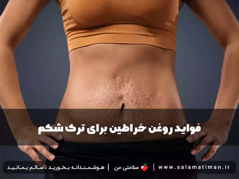 فواید روغن خراطین برای ترک شکم