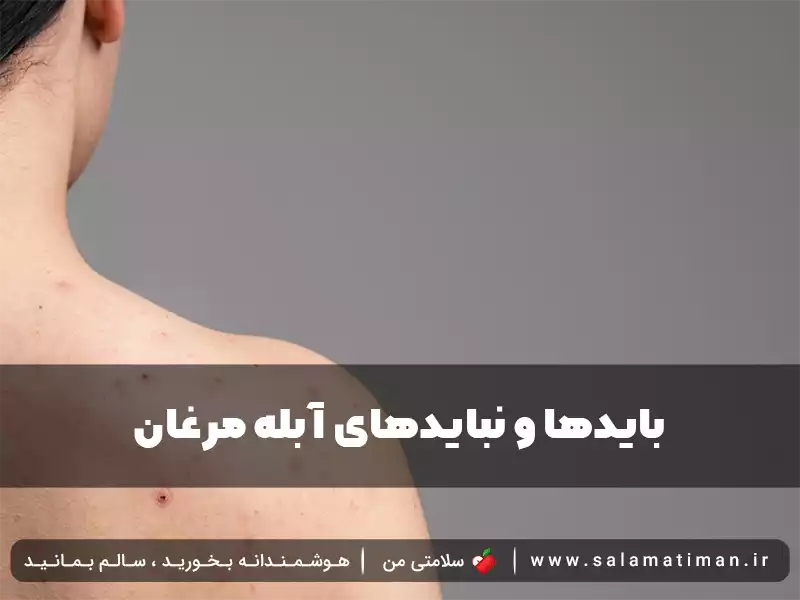 بایدها و نبایدهای آبله مرغان