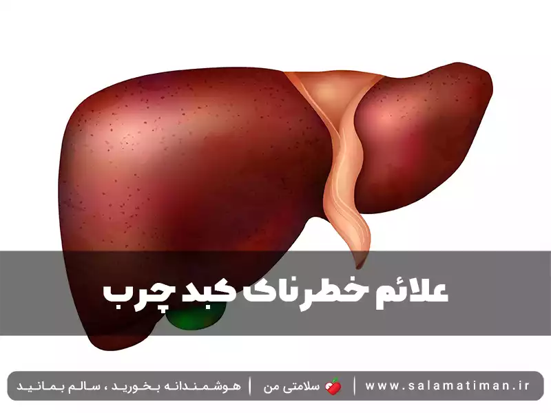 علائم خطرناک کبد چرب