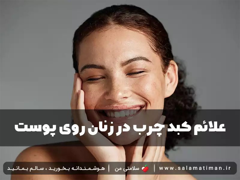 علائم کبد چرب در زنان روی پوست