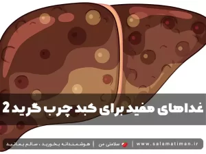 غداهای مفید برای کبد چرب گرید ۲