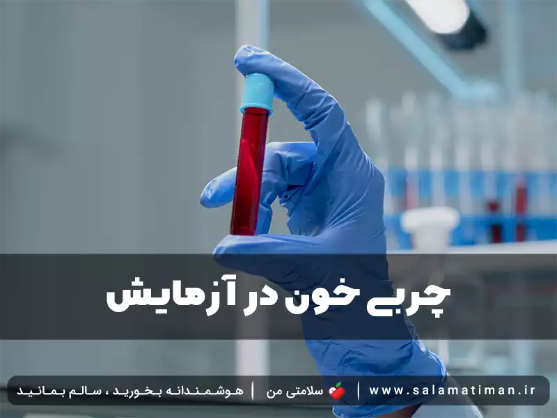 چربی خون در آزمایش