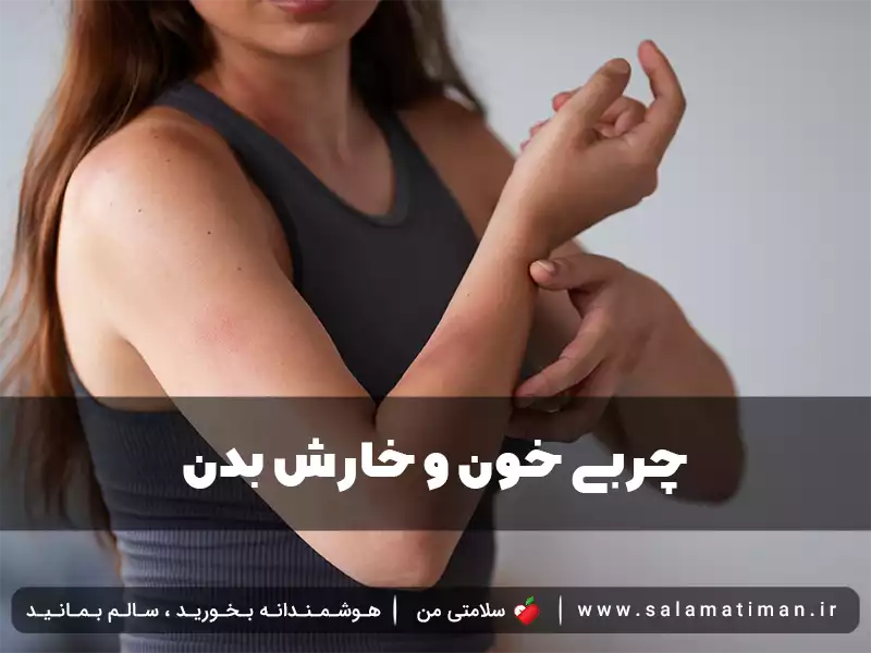 چربی خون و خارش بدن