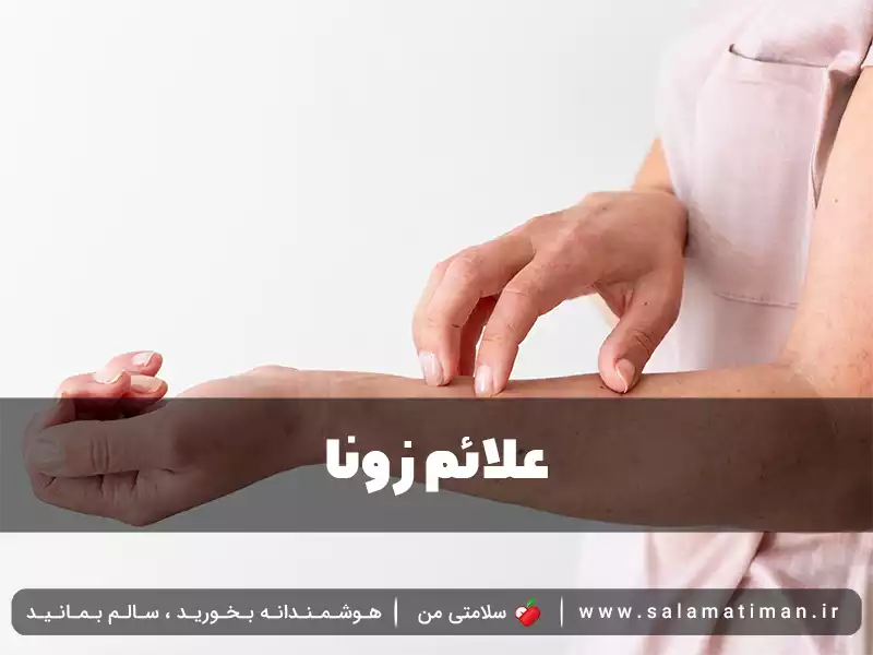 علائم زونا