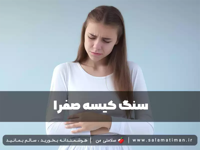 سنگ کیسه صفرا