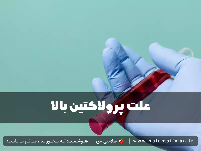 علت پرولاکتین بالا