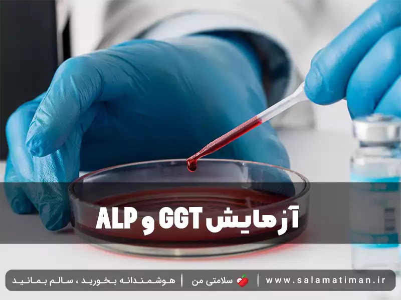 آزمایش ALP و GGT