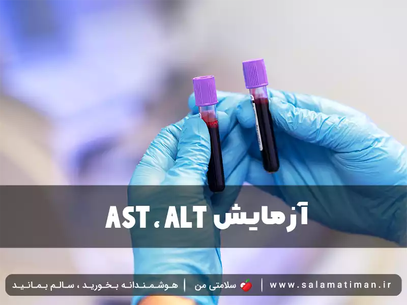 آزمایش AST , ALT