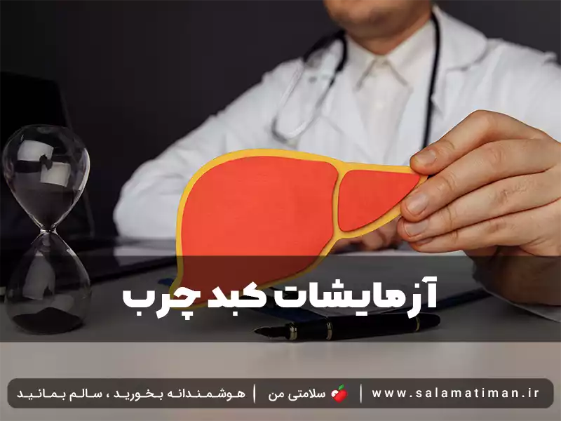 آزمایشات کبد چرب