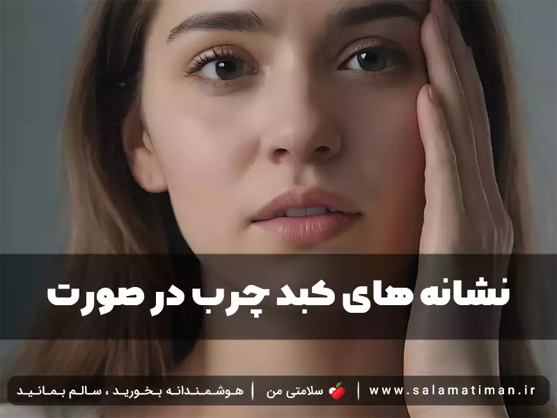 نشانه های کبد چرب در صورت