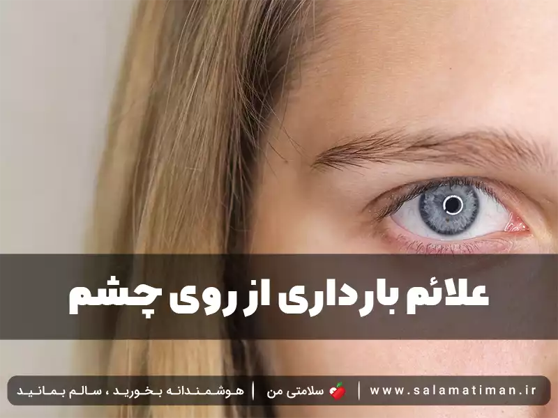 علائم بارداری از روی چشم