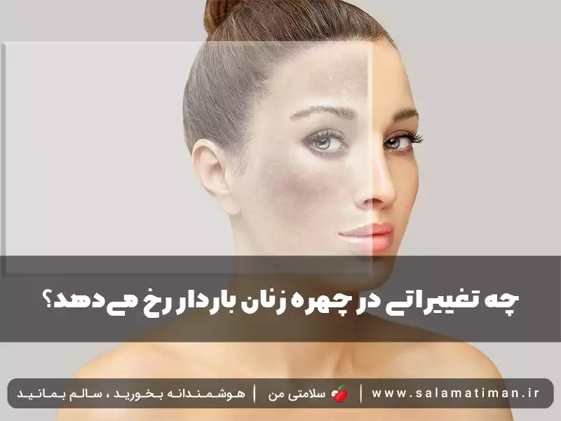 چه تغییراتی در چهره زنان باردار رخ می‌دهد؟