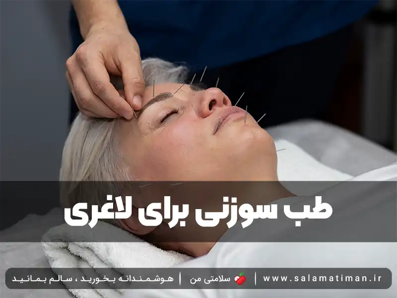 طب سوزنی برای لاغری